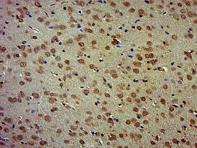 SOX2 Antibody in Immunohistochemistry (Paraffin) (IHC (P))