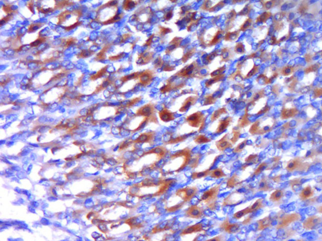 SOX2 Antibody in Immunohistochemistry (Paraffin) (IHC (P))