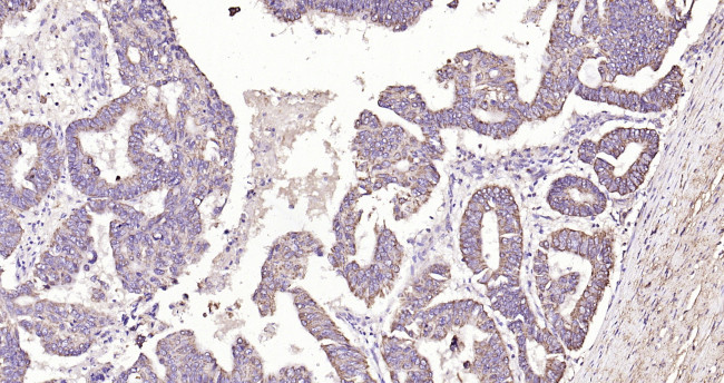 MCL1 Antibody in Immunohistochemistry (Paraffin) (IHC (P))