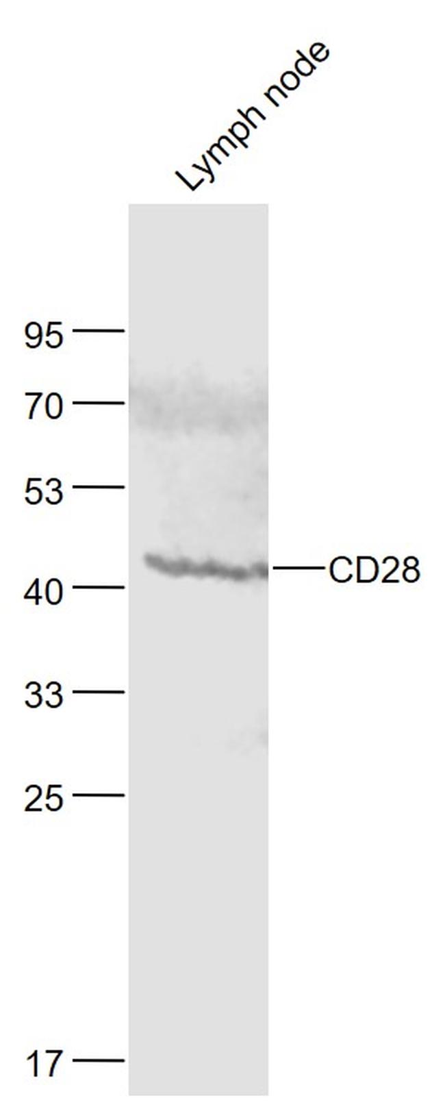 CD28 Antibody in Western Blot (WB)