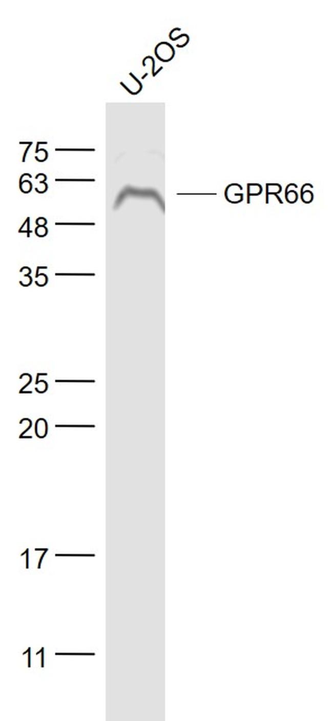 NMUR1 Antibody in Western Blot (WB)