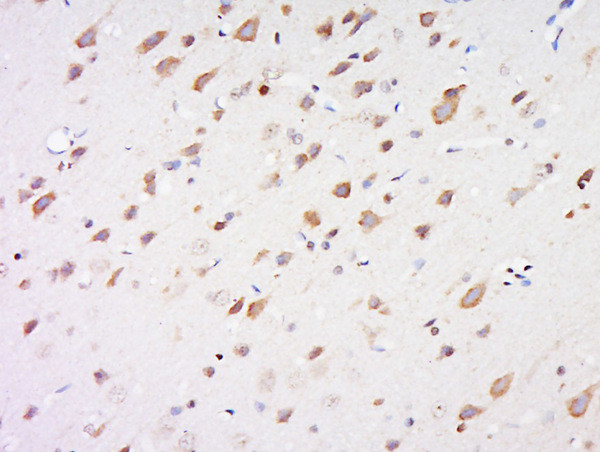 LPL protein/Lipoprotein lipase Antibody in Immunohistochemistry (Paraffin) (IHC (P))