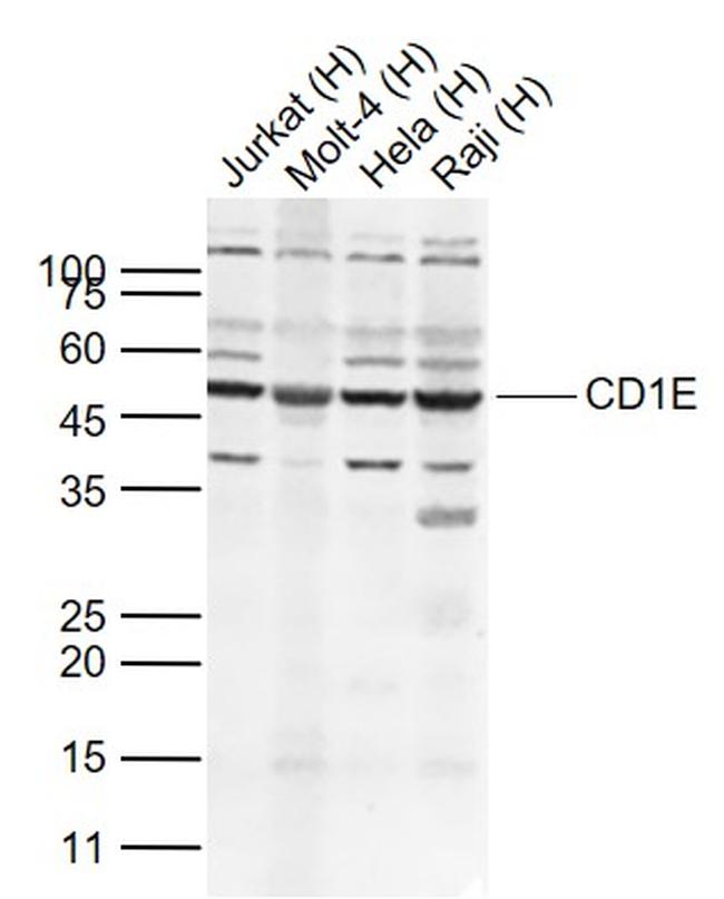 CD1E Antibody in Western Blot (WB)