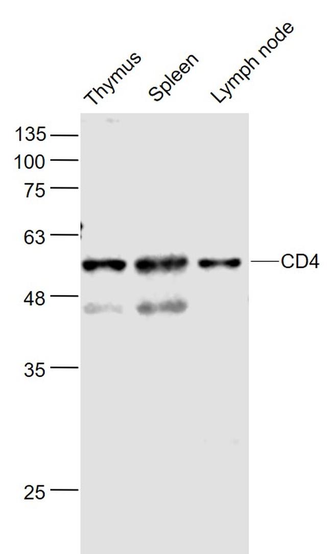 CD4 Antibody in Western Blot (WB)