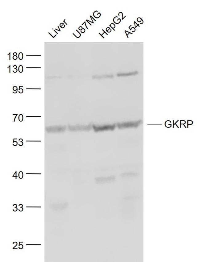 GKRP Antibody in Western Blot (WB)
