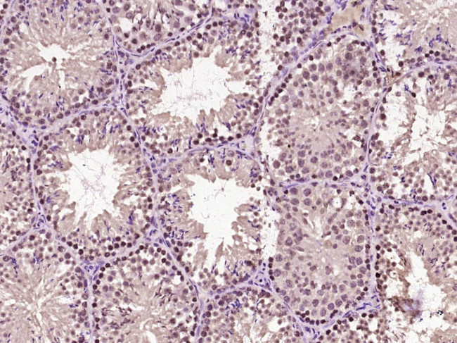Beta catenin Antibody in Immunohistochemistry (Paraffin) (IHC (P))
