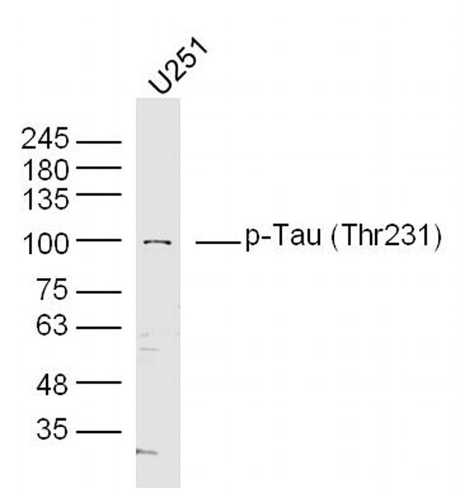 Phospho-Tau (Thr548) Antibody in Western Blot (WB)