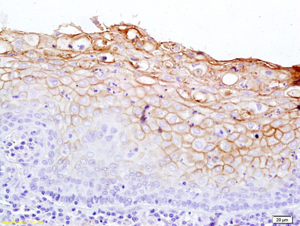 Notch 2 Antibody in Immunohistochemistry (Paraffin) (IHC (P))