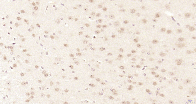 CDKN2A/p16-INK4a Antibody in Immunohistochemistry (Paraffin) (IHC (P))