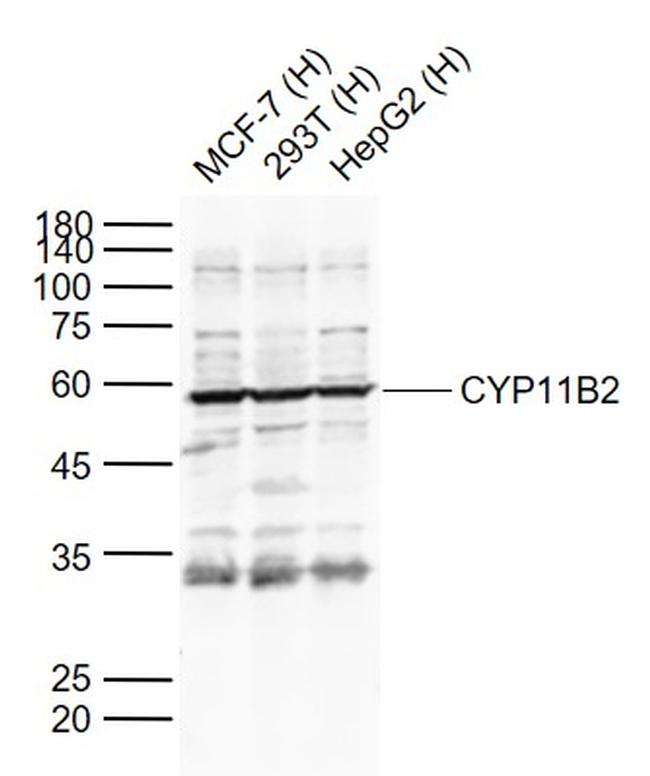 CYP11B2 Antibody in Western Blot (WB)