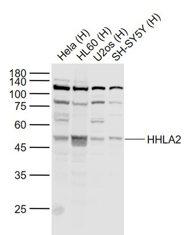 HHLA2 Antibody in Western Blot (WB)