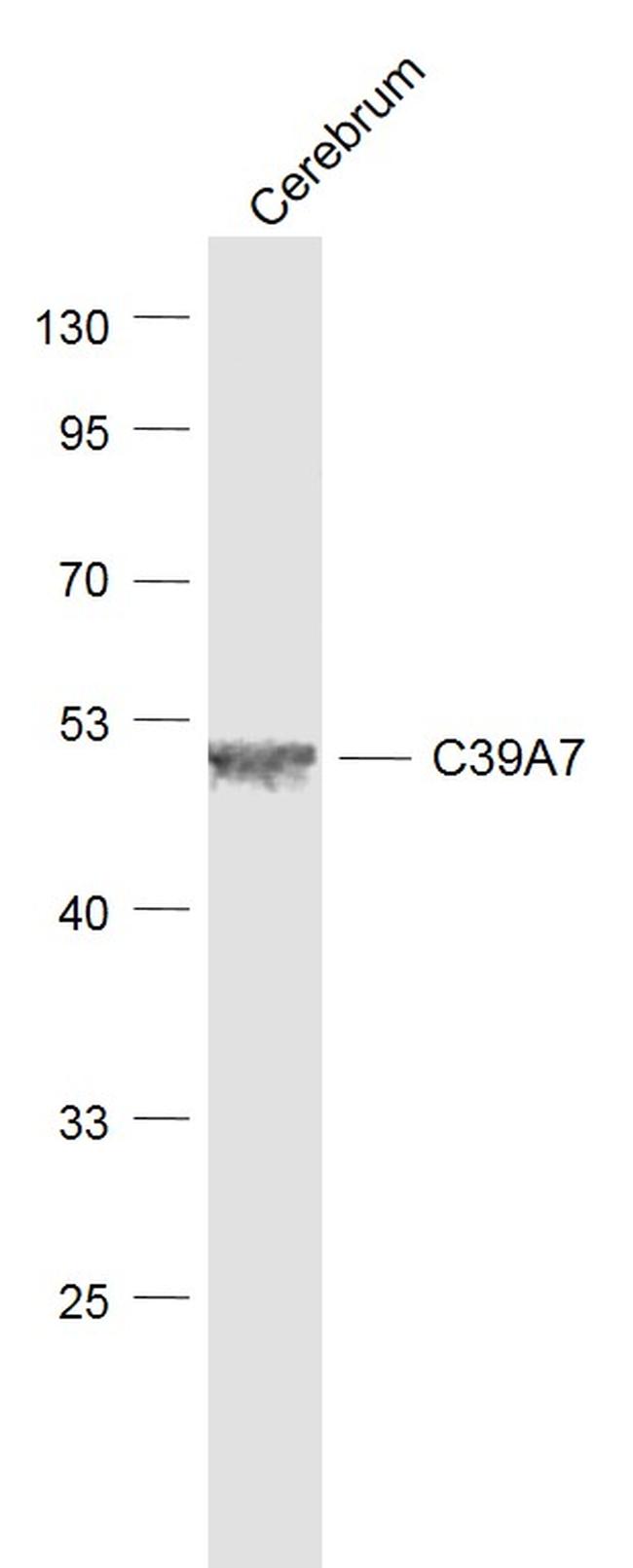 SLC39A7 Antibody in Western Blot (WB)