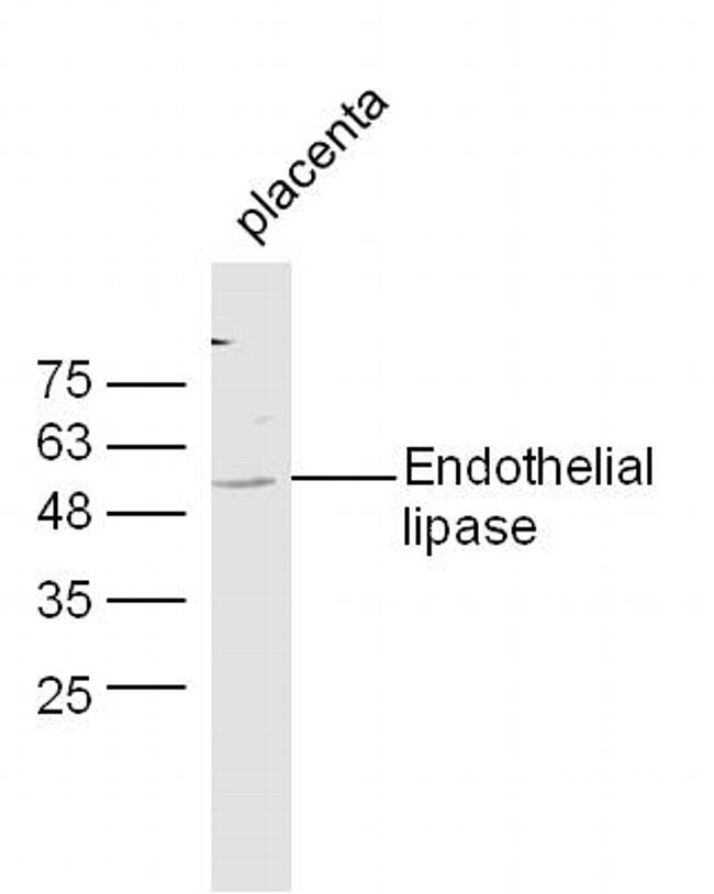 Endothelial lipase Antibody in Western Blot (WB)