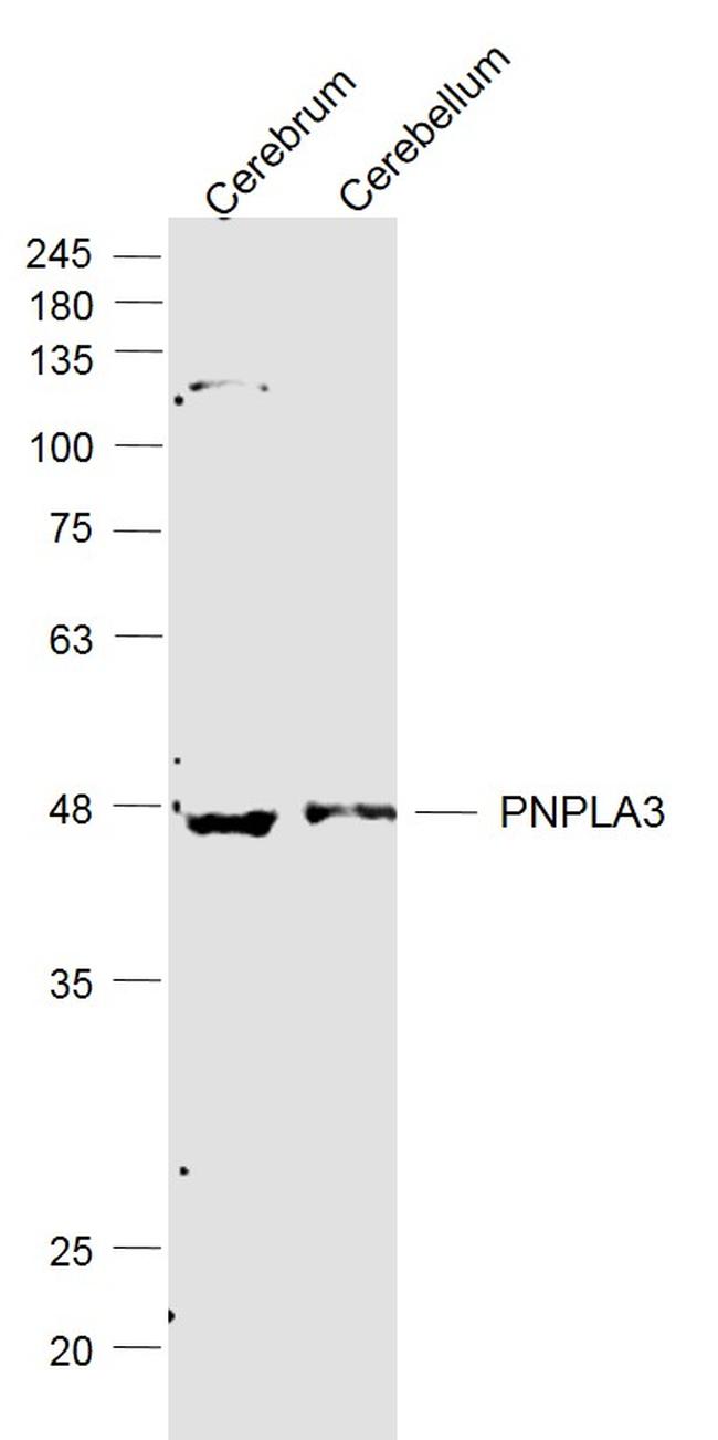 PNPLA3 Antibody in Western Blot (WB)