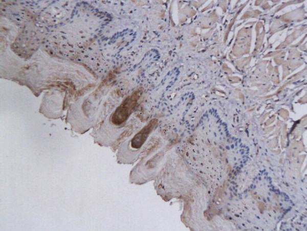 AKR1B1 Antibody in Immunohistochemistry (Paraffin) (IHC (P))