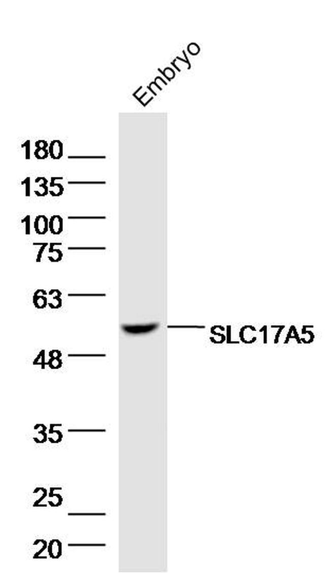 SLC17A5 Antibody in Western Blot (WB)