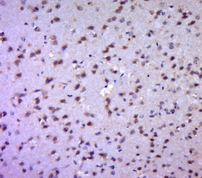 Aldolase A, Aldolase B Antibody in Immunohistochemistry (Paraffin) (IHC (P))