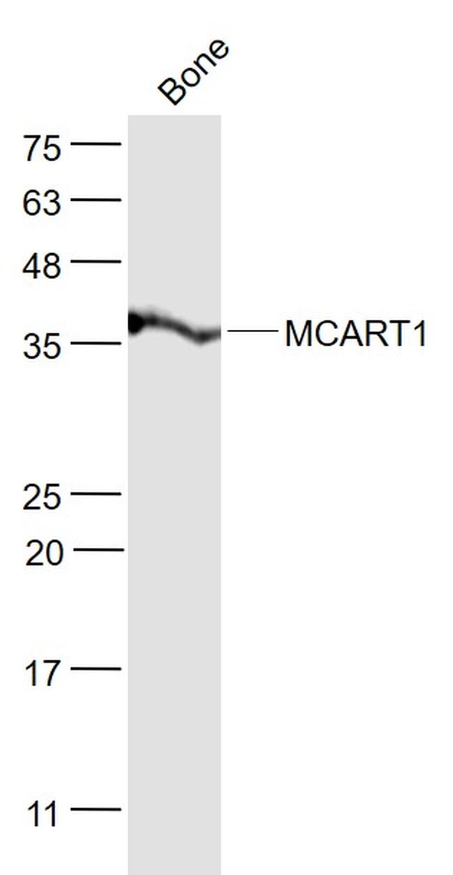 MCART1 Antibody in Western Blot (WB)