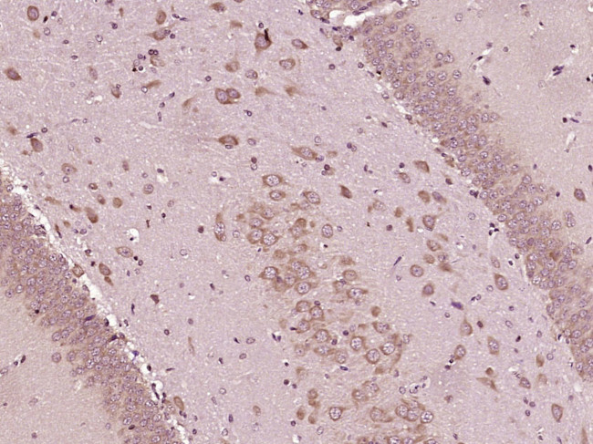 MCFD2 Antibody in Immunohistochemistry (Paraffin) (IHC (P))
