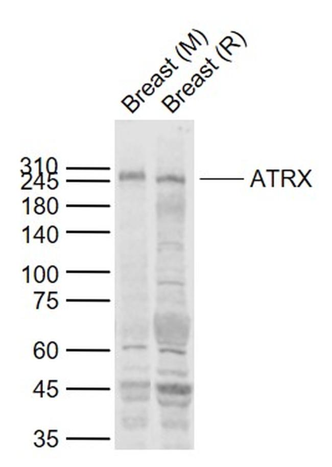 ATRX Antibody in Western Blot (WB)