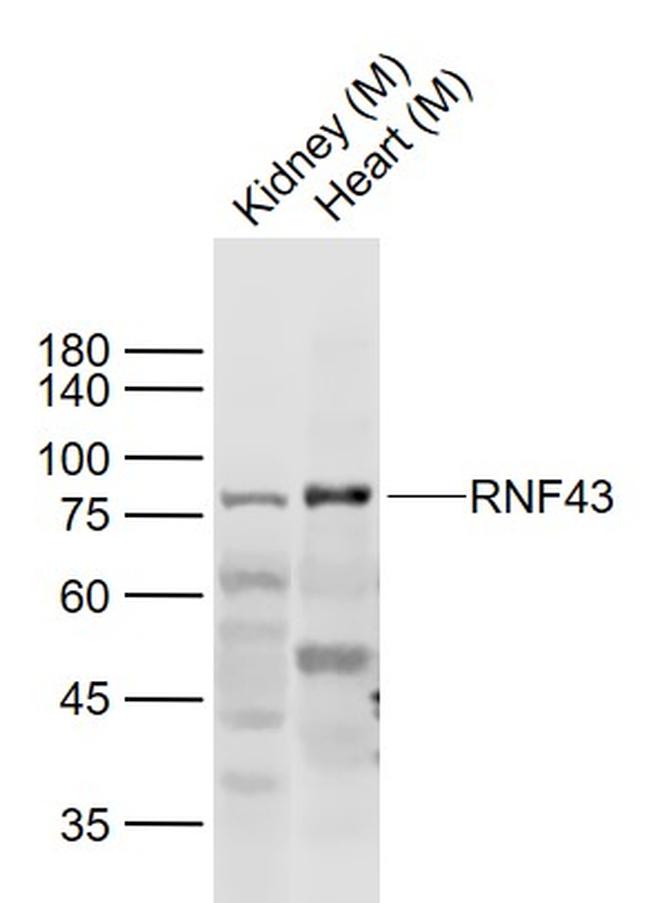 RNF43 Antibody in Western Blot (WB)
