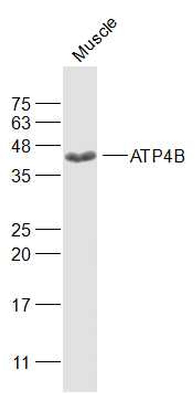 ATP4B Antibody in Western Blot (WB)