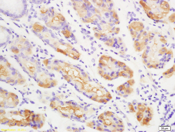 ENPP2 Antibody in Immunohistochemistry (Paraffin) (IHC (P))