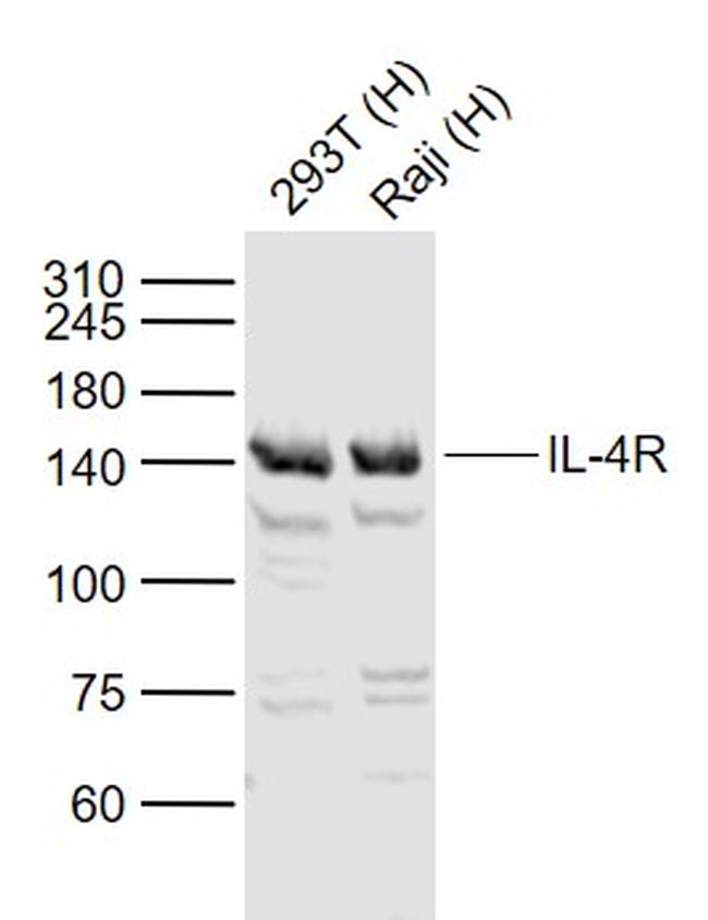 IL-4R Antibody in Western Blot (WB)