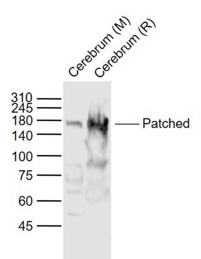 Patched Antibody in Western Blot (WB)