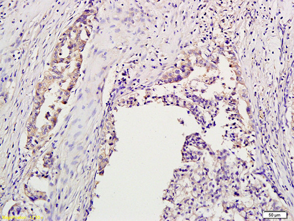Aurora A/B/C Antibody in Immunohistochemistry (Paraffin) (IHC (P))