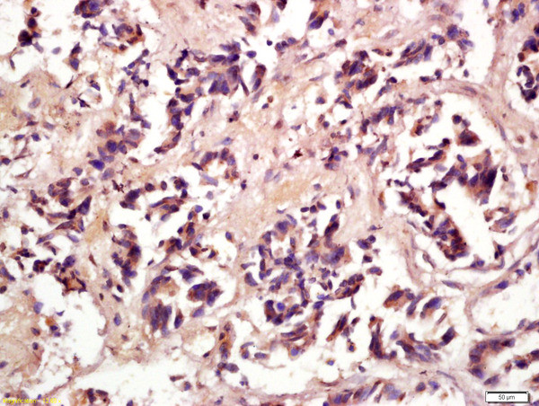 Phospho-eIF4E (Ser209) Antibody in Immunohistochemistry (Paraffin) (IHC (P))