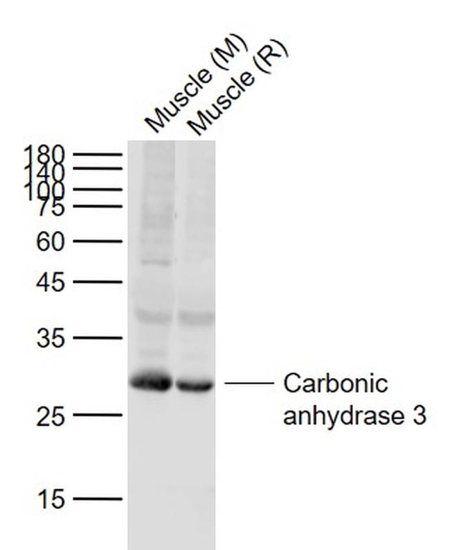 Carbonic anhydrase 3 Antibody in Western Blot (WB)