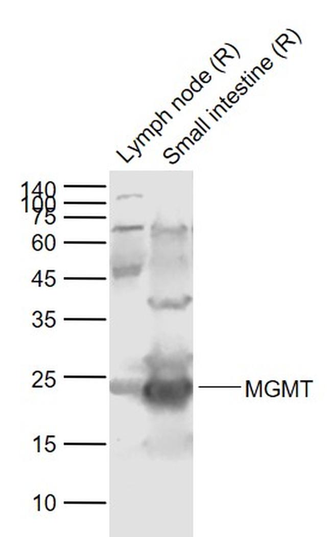 MGMT Antibody in Western Blot (WB)