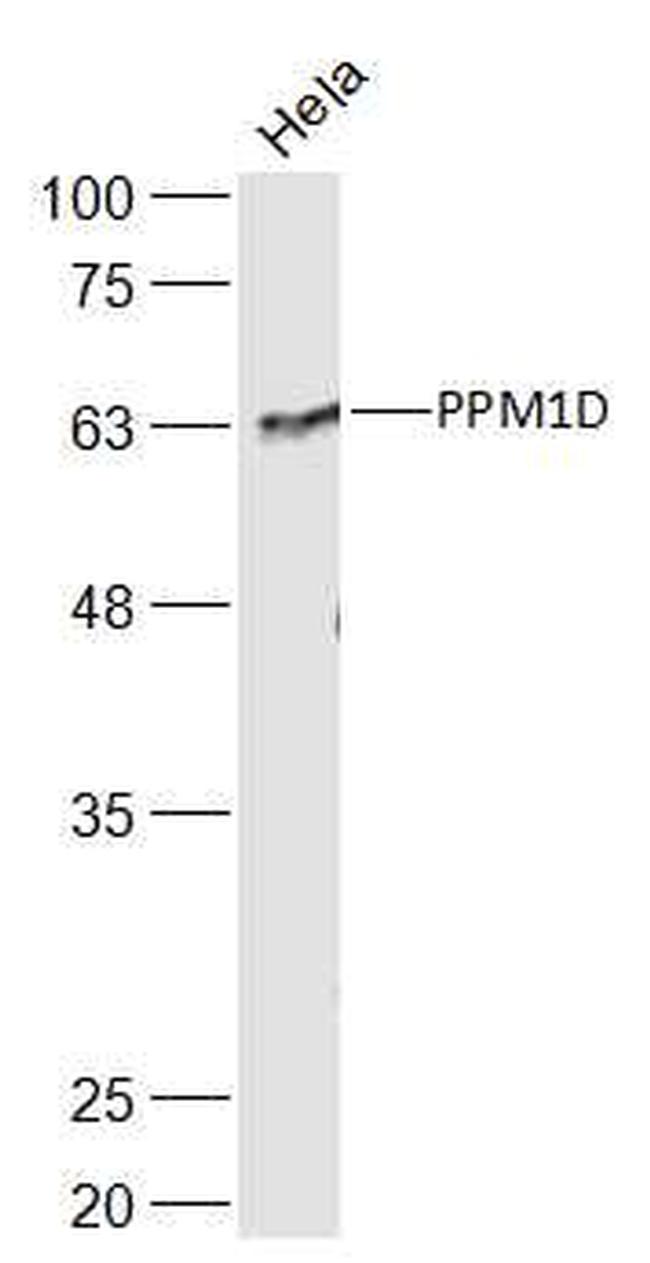 PPM1D Antibody in Western Blot (WB)