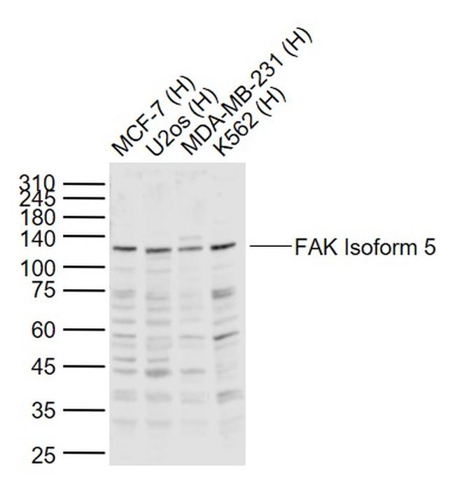 FAK Isoform 5 Antibody in Western Blot (WB)