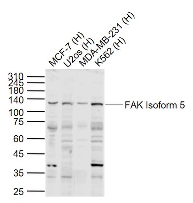 FAK Isoform 5 Antibody in Western Blot (WB)
