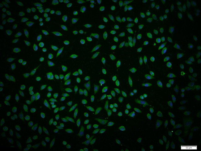 IL4R Antibody in Immunocytochemistry (ICC/IF)