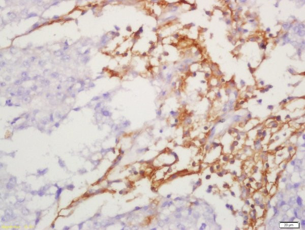 IL-13Ra2 Antibody in Immunohistochemistry (Paraffin) (IHC (P))