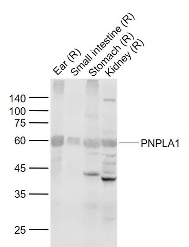 PNPLA1 Antibody in Western Blot (WB)
