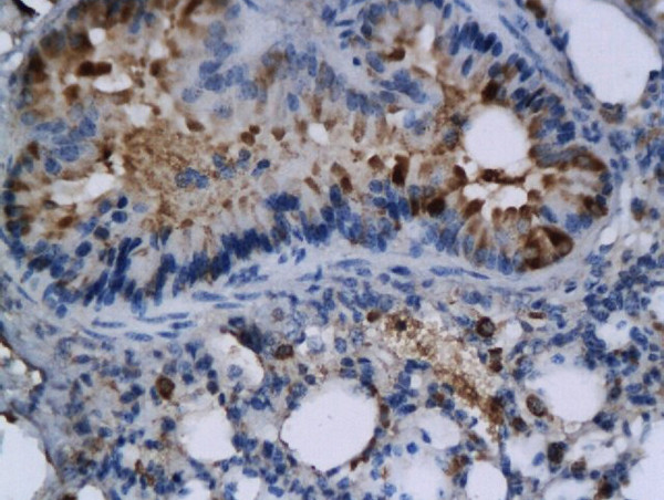 TNFSF4/CD252 Antibody in Immunohistochemistry (Paraffin) (IHC (P))
