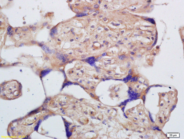 K14 protein Antibody in Immunohistochemistry (Paraffin) (IHC (P))