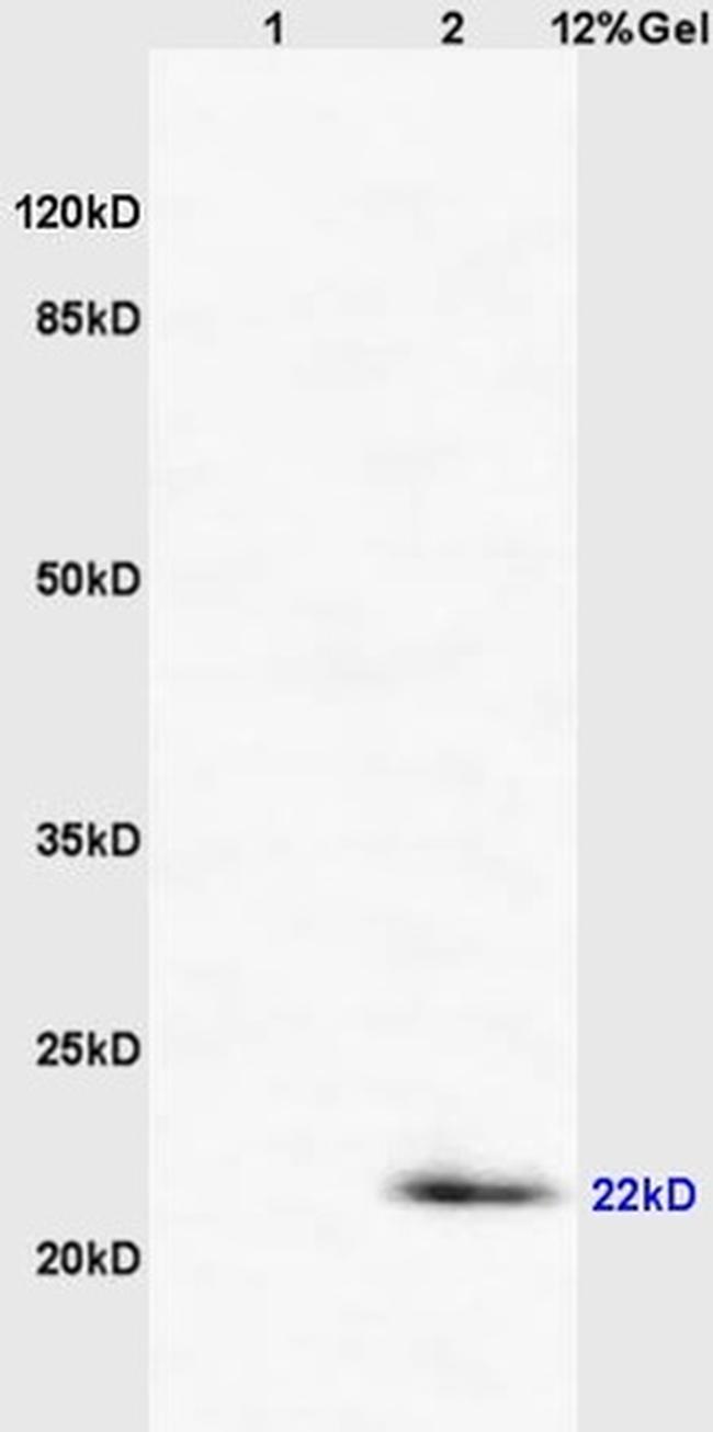 CD69/CLEC2C/AIM Antibody in Western Blot (WB)