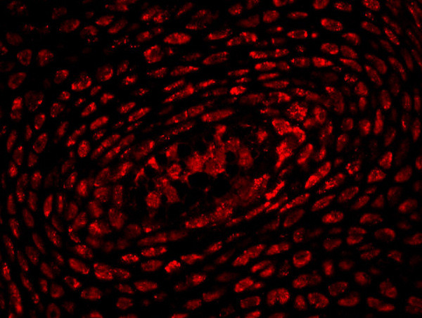 HOXA10 Antibody in Immunohistochemistry (Paraffin) (IHC (P))