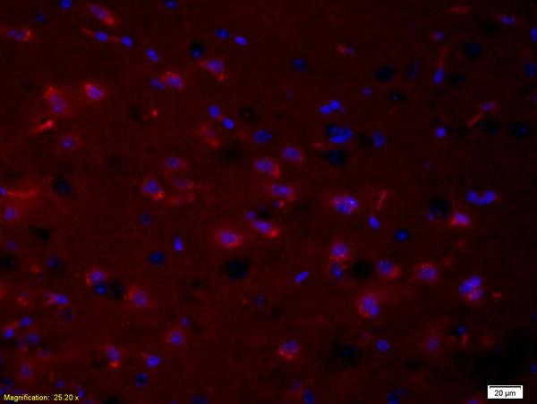 Phospho-PRKCB (Thr500) Antibody in Immunohistochemistry (Paraffin) (IHC (P))