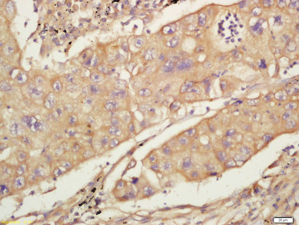 CD44 Antibody in Immunohistochemistry (Paraffin) (IHC (P))