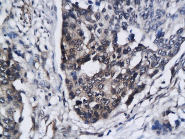 CCR5/CD195 Antibody in Immunohistochemistry (Paraffin) (IHC (P))