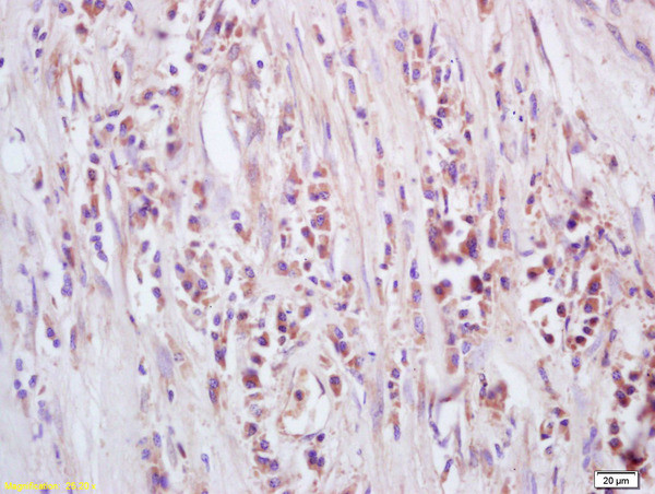 GTSE-1 Antibody in Immunohistochemistry (Paraffin) (IHC (P))