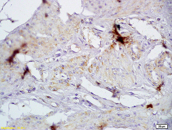 CD72/Ly-32 Antibody in Immunohistochemistry (Paraffin) (IHC (P))
