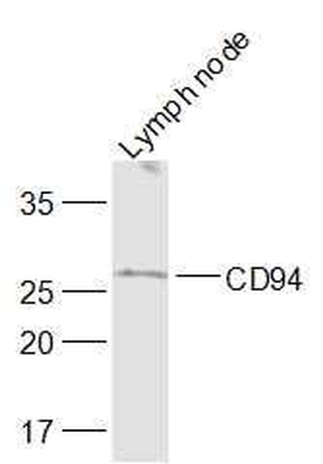 CD94/KLRD1 Antibody in Western Blot (WB)