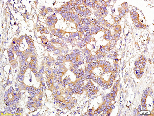 CD151 Antibody in Immunohistochemistry (Paraffin) (IHC (P))